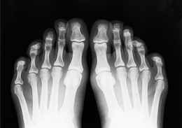 feetxray