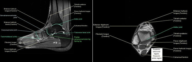 The Mri Technologist Role In Footankle Positioning All American